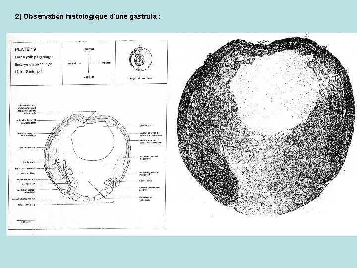 2) Observation histologique d’une gastrula : 