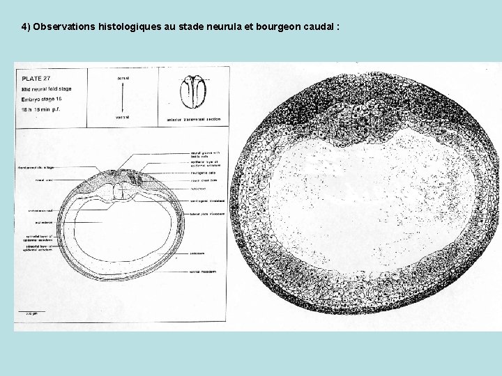 4) Observations histologiques au stade neurula et bourgeon caudal : 