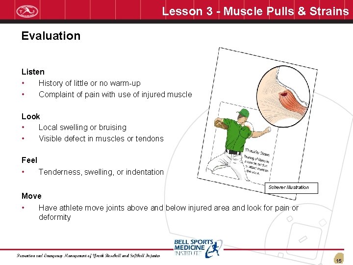 Lesson 3 - Muscle Pulls & Strains Evaluation Listen • History of little or