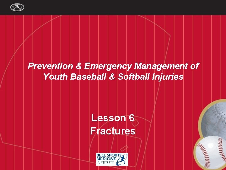 Prevention & Emergency Management of Youth Baseball & Softball Injuries Lesson 6 Fractures 