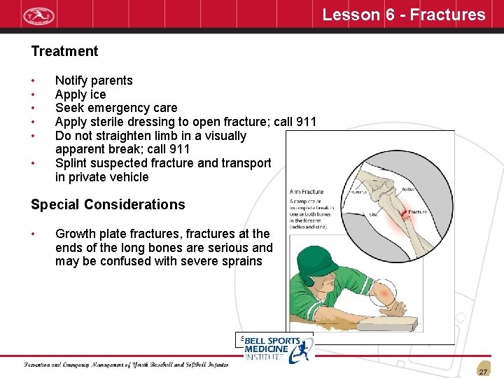 Lesson 6 - Fractures Treatment • • • Notify parents Apply ice Seek emergency