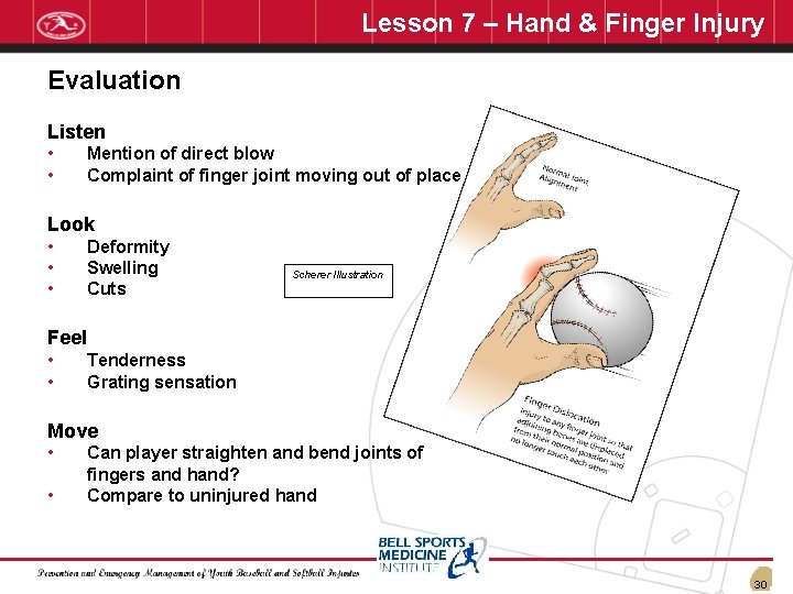 Lesson 7 – Hand & Finger Injury Evaluation Listen • • Mention of direct