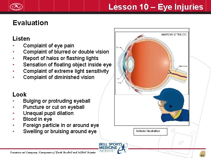 Lesson 10 – Eye Injuries Evaluation Listen • • • Complaint of eye pain