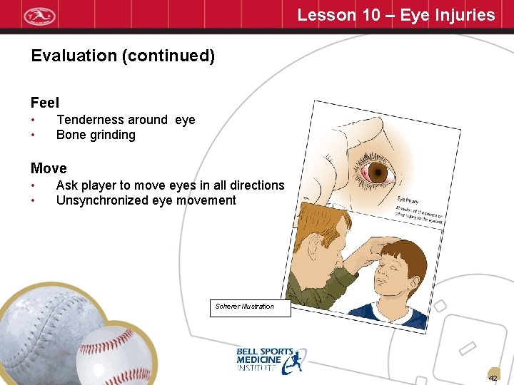Lesson 10 – Eye Injuries Evaluation (continued) Feel • • Tenderness around eye Bone