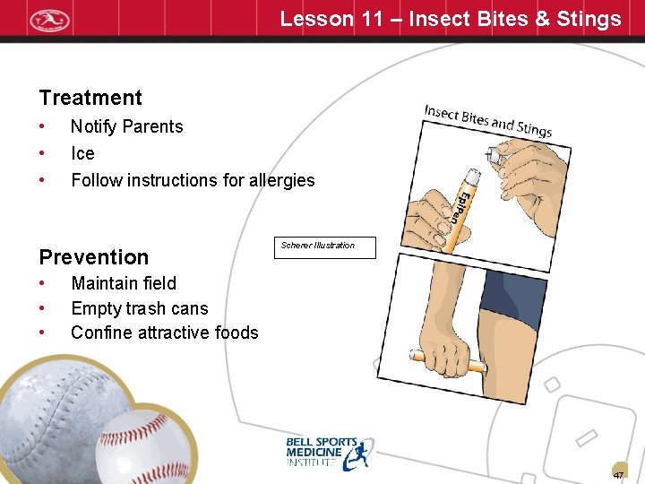 Lesson 11 – Insect Bites & Stings Treatment • • • Notify Parents Ice