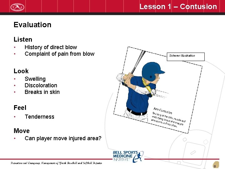 Lesson 1 – Contusion Evaluation Listen • • History of direct blow Complaint of