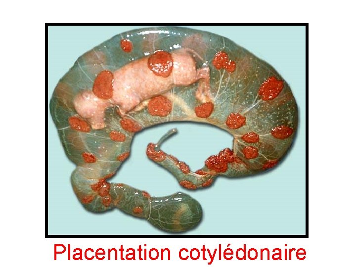 Placentation cotylédonaire 