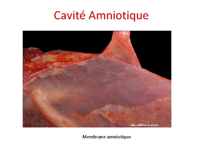 Cavité Amniotique Membrane amniotique 