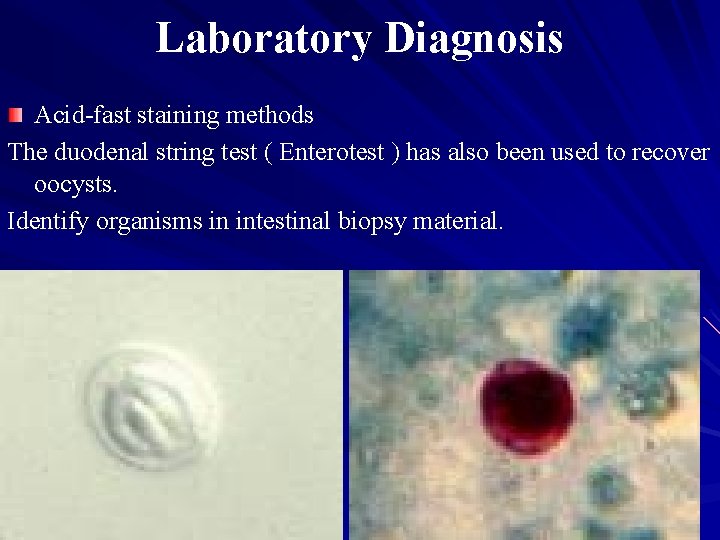 Laboratory Diagnosis Acid-fast staining methods The duodenal string test ( Enterotest ) has also