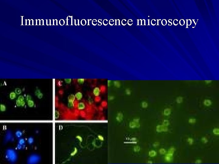 Immunofluorescence microscopy For greatest sensitivity and specificity, it is the method of choice (followed