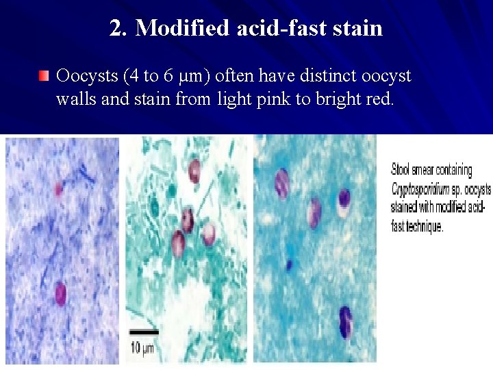 2. Modified acid-fast stain Oocysts (4 to 6 µm) often have distinct oocyst walls