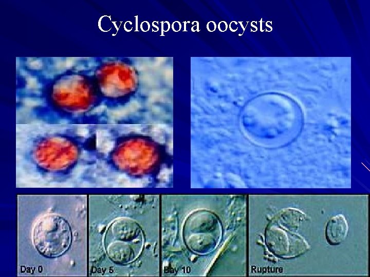 Cyclospora oocysts 