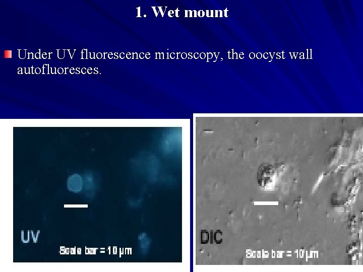 1. Wet mount Under UV fluorescence microscopy, the oocyst wall autofluoresces. 