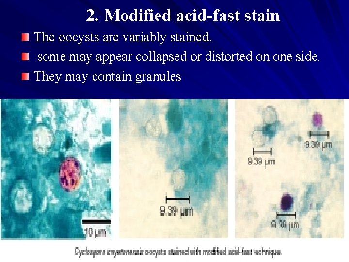 2. Modified acid-fast stain The oocysts are variably stained. some may appear collapsed or