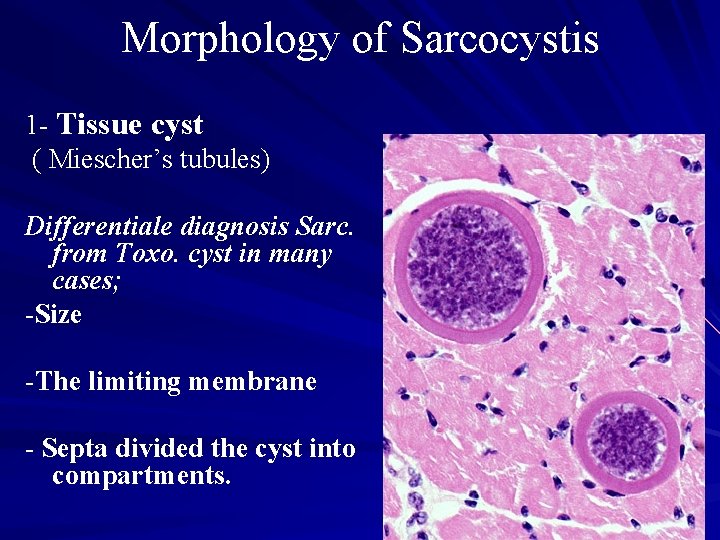 Morphology of Sarcocystis 1 - Tissue cyst ( Miescher’s tubules) Differentiale diagnosis Sarc. from