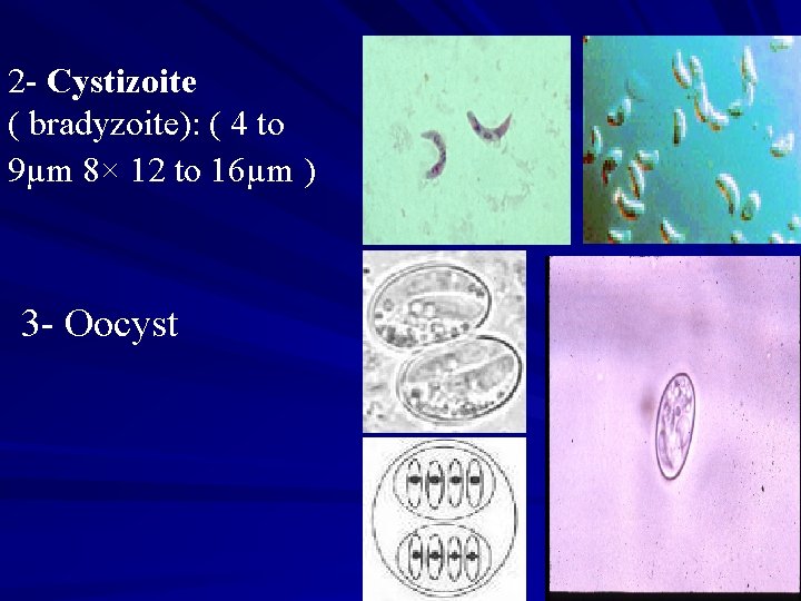 2 - Cystizoite ( bradyzoite): ( 4 to 9µm 8× 12 to 16µm )