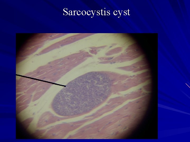 Sarcocystis cyst 