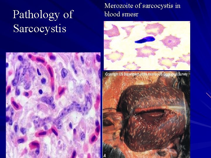 Pathology of Sarcocystis Merozoite of sarcocystis in blood smesr 