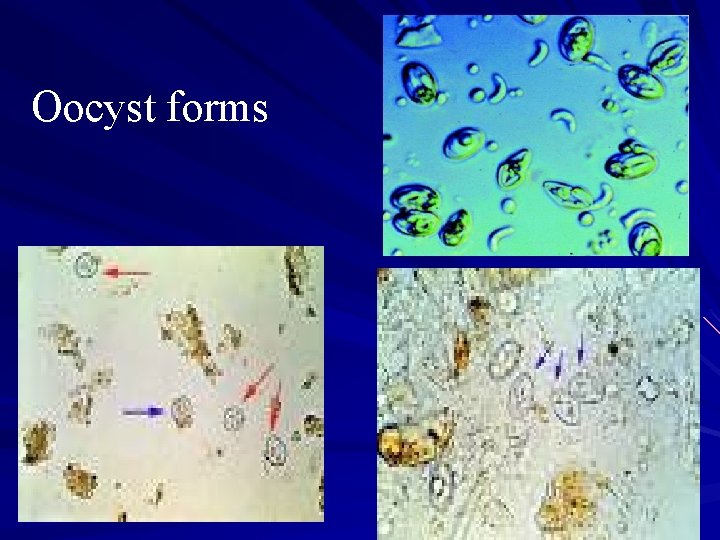 Oocyst forms 