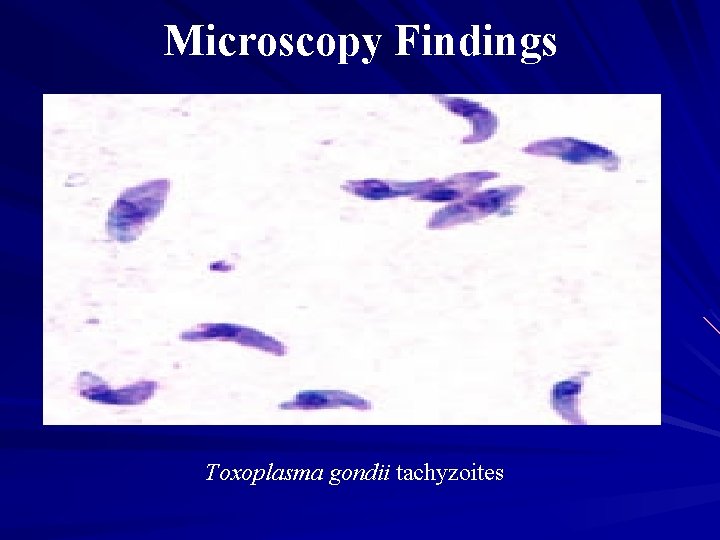 Microscopy Findings A Toxoplasma gondii tachyzoites 