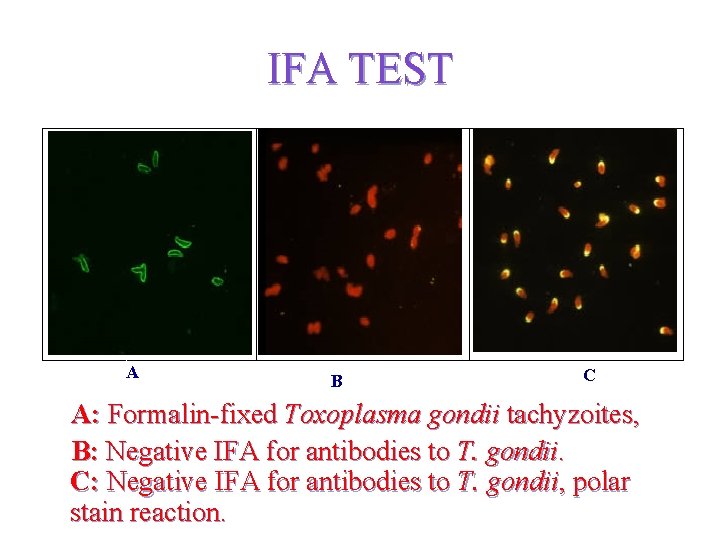 IFA TEST AA B C A: Formalin-fixed Toxoplasma gondii tachyzoites, B: Negative IFA for