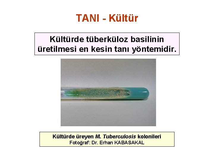 TANI - Kültürde tüberküloz basilinin üretilmesi en kesin tanı yöntemidir. Kültürde üreyen M. Tuberculosis