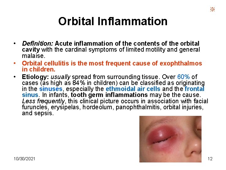 ※ Orbital Inflammation • Definition: Acute inflammation of the contents of the orbital cavity