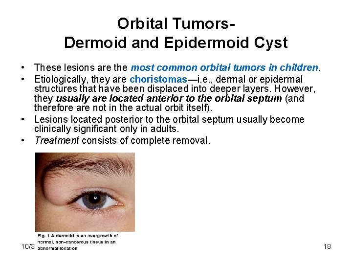 Orbital Tumors. Dermoid and Epidermoid Cyst • These lesions are the most common orbital