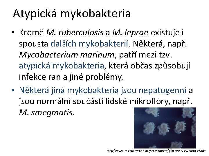 Atypická mykobakteria • Kromě M. tuberculosis a M. leprae existuje i spousta dalších mykobakterií.