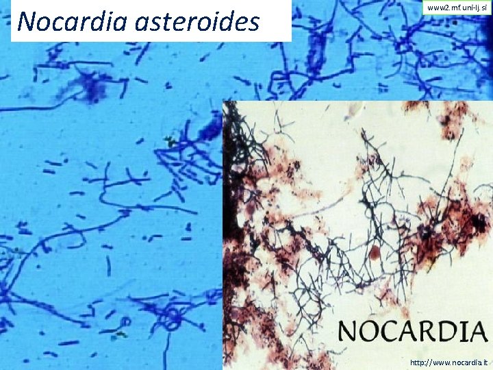 Nocardia asteroides www 2. mf. uni-lj. si http: //www. nocardia. it 