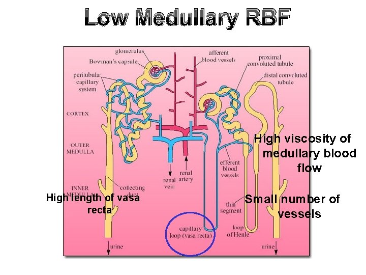 Low Medullary RBF High viscosity of medullary blood flow High length of vasa recta