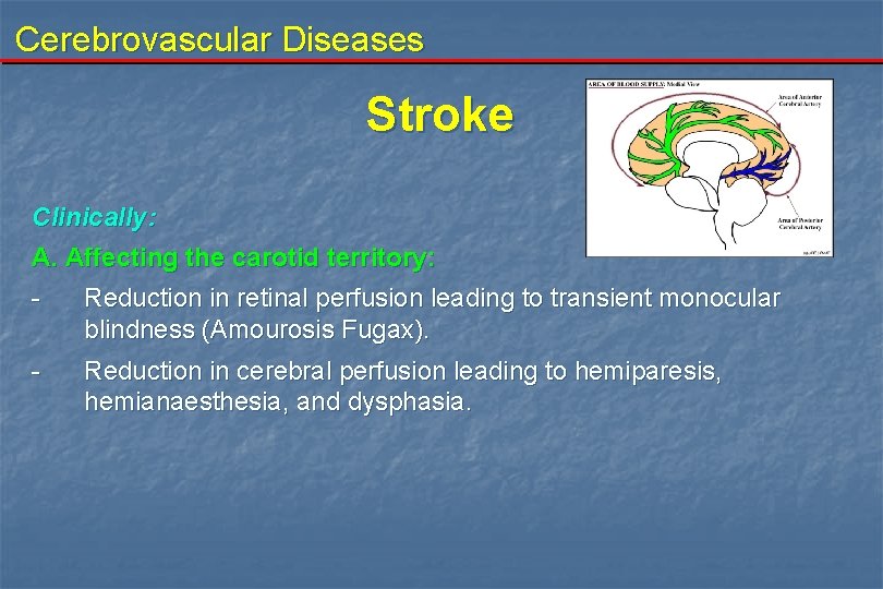Cerebrovascular Diseases Stroke Clinically: A. Affecting the carotid territory: - Reduction in retinal perfusion
