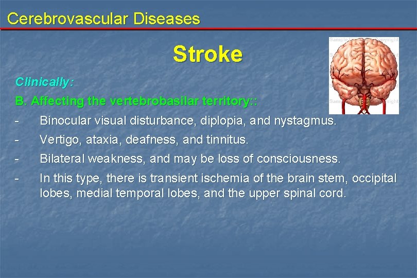 Cerebrovascular Diseases Stroke Clinically: B. Affecting the vertebrobasilar territory: : - Binocular visual disturbance,