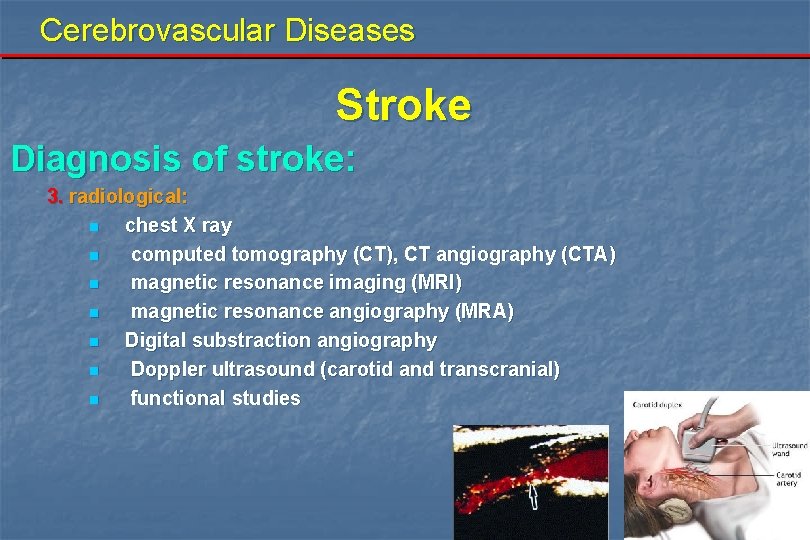 Cerebrovascular Diseases Stroke Diagnosis of stroke: 3. radiological: n chest X ray n computed