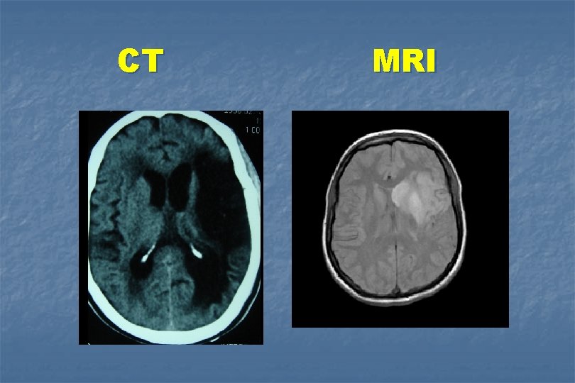 CT MRI 