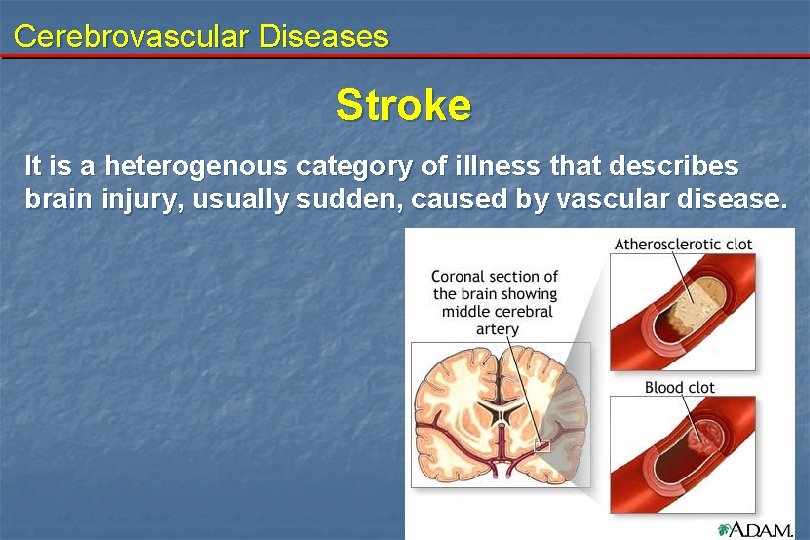 Cerebrovascular Diseases Stroke It is a heterogenous category of illness that describes brain injury,