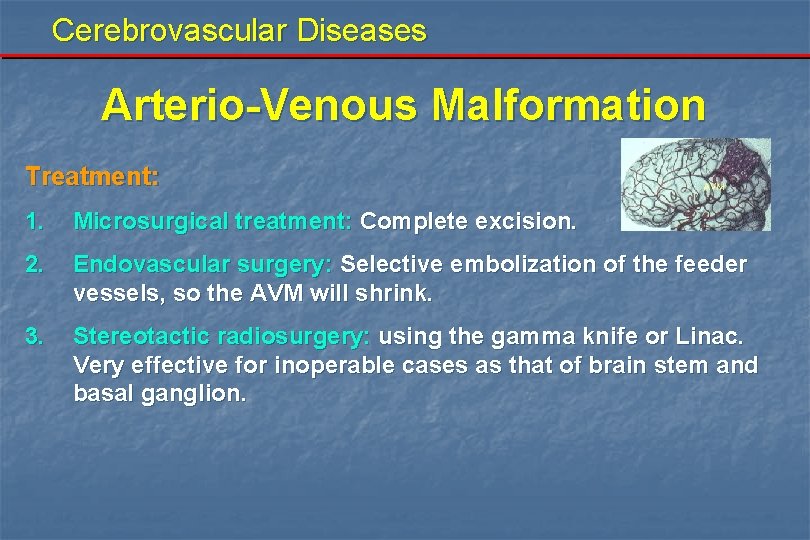 Cerebrovascular Diseases Arterio-Venous Malformation Treatment: 1. Microsurgical treatment: Complete excision. 2. Endovascular surgery: Selective