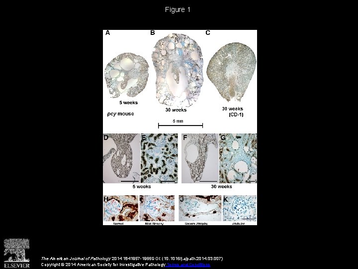 Figure 1 The American Journal of Pathology 2014 1841957 -1966 DOI: (10. 1016/j. ajpath.