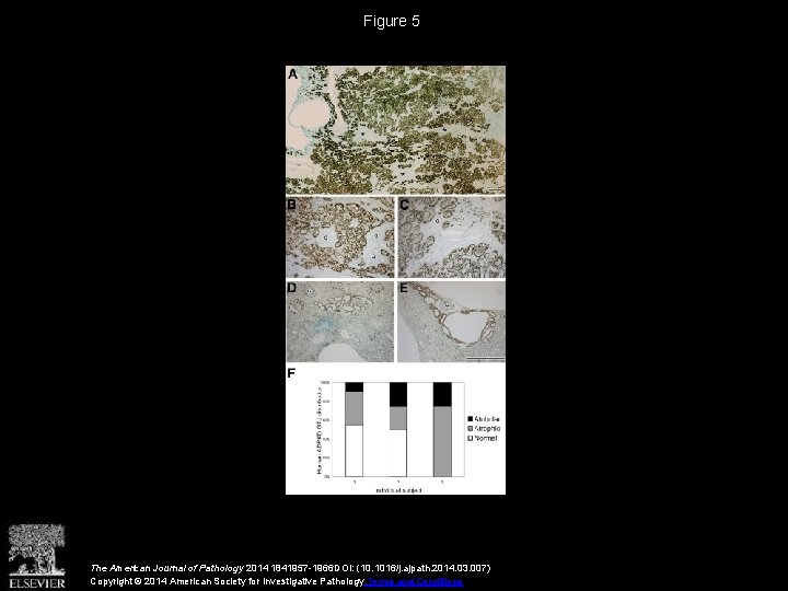 Figure 5 The American Journal of Pathology 2014 1841957 -1966 DOI: (10. 1016/j. ajpath.