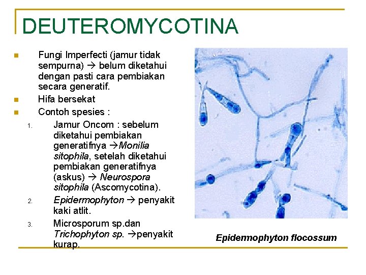 DEUTEROMYCOTINA n n n 1. 2. 3. Fungi Imperfecti (jamur tidak sempurna) belum diketahui