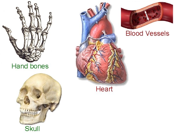 Blood Vessels Hand bones Heart Skull 