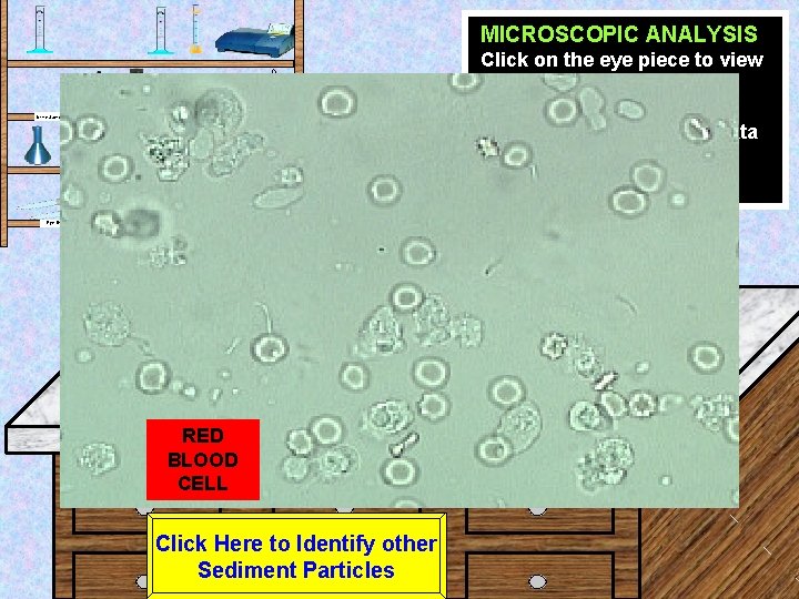 MICROSCOPIC ANALYSIS Click on the eye piece to view the sample at High power.