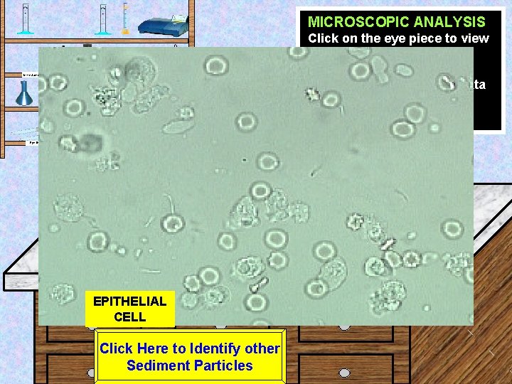 MICROSCOPIC ANALYSIS Click on the eye piece to view the sample at High power.