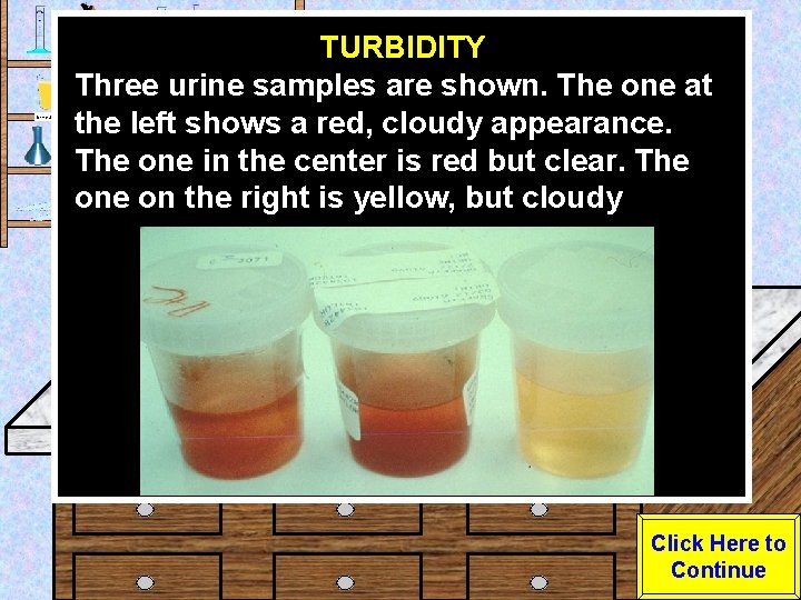 Urine Sample TURBIDITY Three urine samples are shown. The one at the left shows