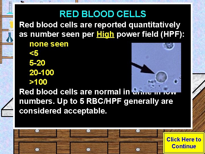 RED BLOOD CELLS Urine Sample Red blood cells are reported quantitatively as number seen