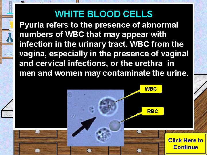 WHITE BLOOD CELLS Urine Sample Pyuria refers to the presence of abnormal numbers of