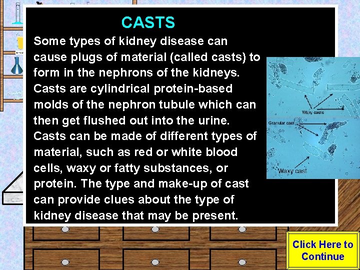 CASTS Urine Sample Some types of kidney disease can cause plugs of material (called