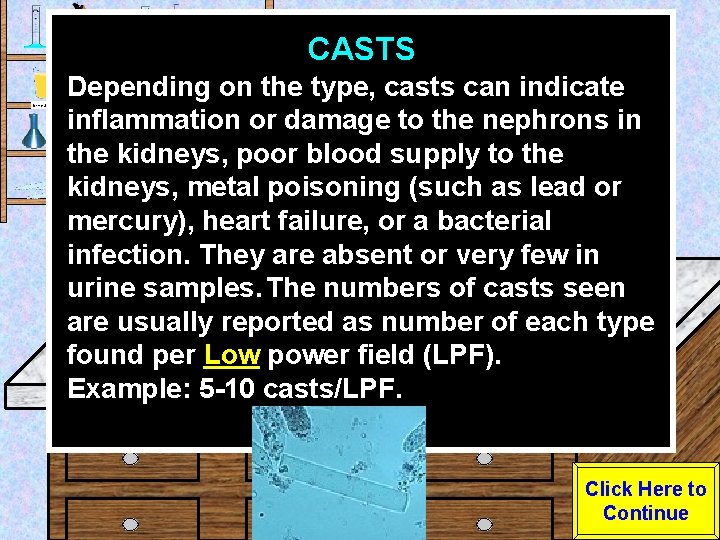 CASTS Urine Sample Depending on the type, casts can indicate inflammation or damage to