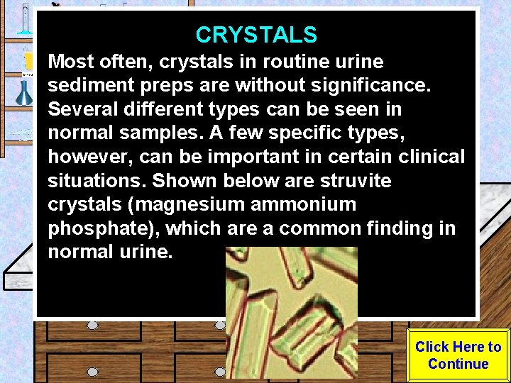 CRYSTALS Urine Sample Most often, crystals in routine urine sediment preps are without significance.