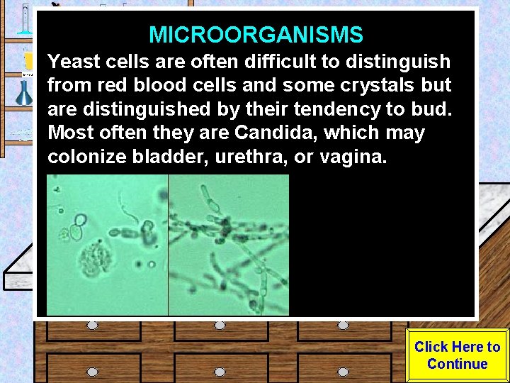 MICROORGANISMS Urine Sample Yeast cells are often difficult to distinguish from red blood cells